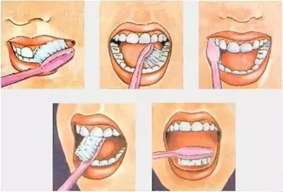 不得不信——80%多的问题都出现在牙龈上